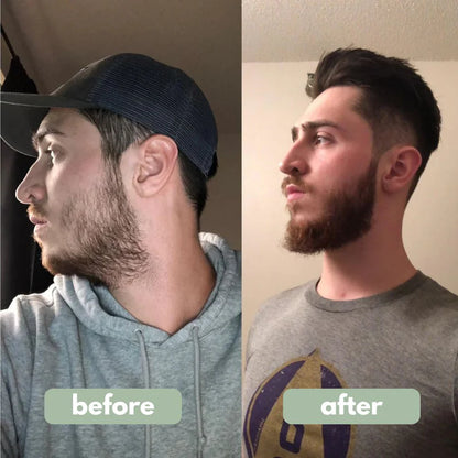 Rosemary Hair Growth Roller